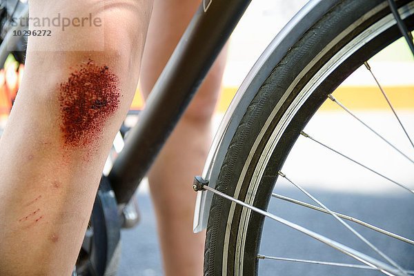 Ausschnitt des Fahrrad- und Mädchenbeins mit gestreiftem Knie