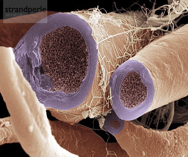 Nervenfasern  SEM