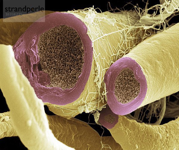 Nervenfasern  SEM