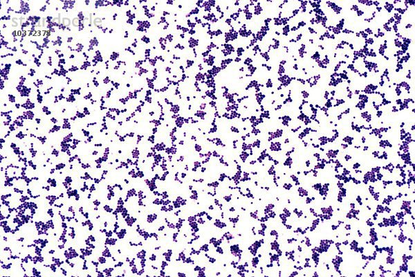 Staphylococcus aureus  eine gram-positive Kokkusbakterie  Gram-Färbung. LM X315.