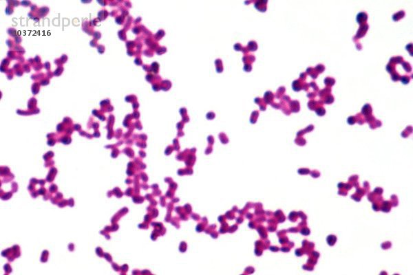 (Neisseria gonorrhoeae) die Bakterien  die Gonorrhoe verursachen. LM X800
