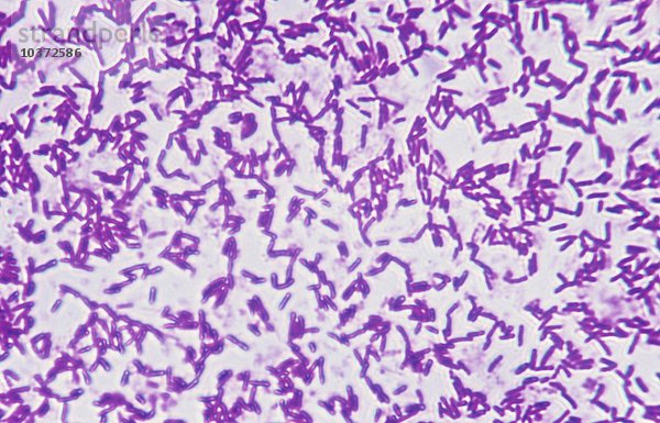 Chromobacterium Bacteria  eine gramnegative  fakultativ anaerobe  nicht sporenbildende Coccobacillus  die in Wasser und Boden verbreitet ist. LM.