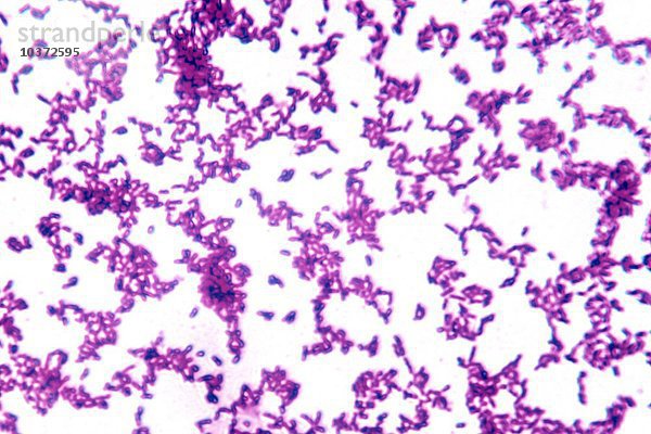 Shigella dysenteriae Bakterien sind pathogene Bazillen  die Dysenterie verursachen. LM X600
