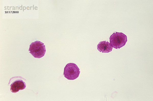 Dinoflagellaten (Peridinium). LM