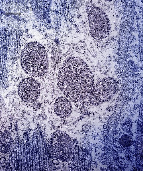 Mitochondrien in einem Myokardschnitt aus dem menschlichen Vorhof. TEM