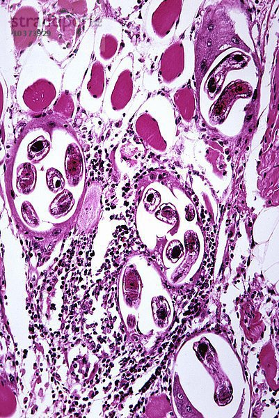 Trichinose  mit Trichinella-Würmern im Skelettmuskel  H&E-Färbung. LM X50.