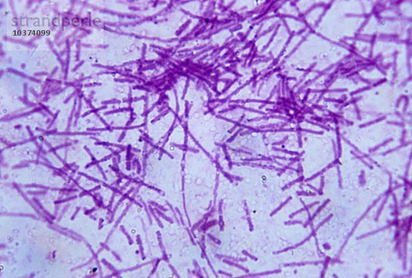 Anthrax-Bakterien (Bacillus anthracis). LM X1200