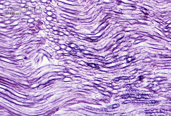 Längsschnitt eines menschlichen myelinisierten Nervs. LM X10