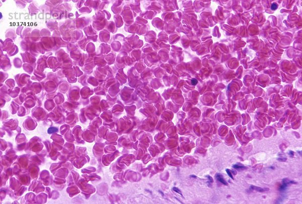 Menschliche rote Blutkörperchen oder Erythrozyten  die ihre bikonkave Form zeigen. LM X400.