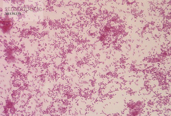 Enterobacter aerogenes Bakterien sind gramnegative Stäbchen  die als nosokomiale Krankheitserreger für eine Vielzahl von Infektionen verantwortlich sind. Aufgrund der Probleme  die sie bei Patienten verursachen  die über einen längeren Zeitraum im Krankenhaus liegen  werden sie manchmal auch als ICU-Bugs bezeichnet. LM X160.