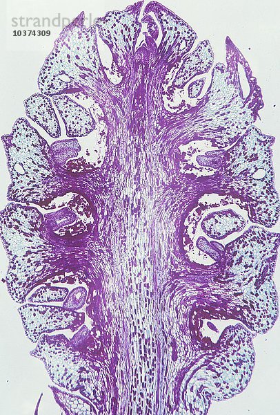 Längsschnitt durch einen weiblichen Strobilus der Riesenmammutbäume (Sequoiadendron giganteum). LM X3.