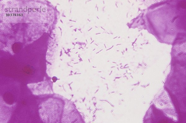 Bakterien im Vaginalvorhof. LM X250.