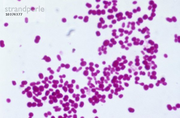 Streptococcus pneumoniae Bakterium  einer der Erreger von Lungenentzündung und anderen menschlichen Krankheiten. Hellfeld  LM X800.