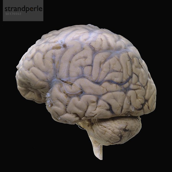 Menschliches Gehirn  Seitenfläche  mit intakter Arachnoidea und äußeren Hirnvenen. Der Brian zeigt das Großhirn  die Großhirnarterien  das Kleinhirn und das Hinterhirn. Das Kleinhirn ist für das Gleichgewicht und die Steuerung der Muskeln zuständig. Das Gehirn enthält mehr als 300 Milliarden Neuronen und besteht hauptsächlich aus grauer Substanz  die Nervenimpulse erzeugt und verarbeitet  und weißer Substanz  die die Impulse weiterleitet.