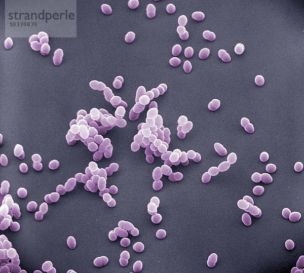 Staphylococcus aureus-Bakterien  die Ursache einer Vielzahl von Infektionen beim Menschen und eine häufige Ursache für Lebensmittelvergiftungen. SEM X14.000 bei 4 x 4