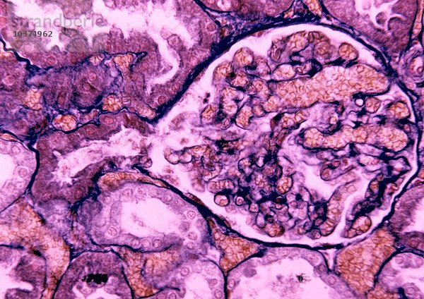 Glomerulus in der Niere mit einer zuführenden Arterie und einem Teil eines Tubulus convolutus. LM X110.