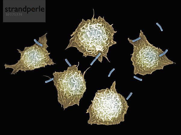 Makrophagen fangen Bakterien zum Verzehr ein  Phagozytose . Diese Tätigkeit ist ein wichtiger Bestandteil des menschlichen Immunsystems. Makrophagen stammen von Monozyten ab  einer Art weißer Blutkörperchen. Ihre Aufgabe ist es  durch Phagozytose Fremdkörper  Bakterien  Viren sowie tote und absterbende Zellen im Körper zu zerstören. Makrophagen spielen eine wichtige Rolle bei der Stimulierung einer zusätzlichen Immunreaktion  indem sie Antigene präsentieren  die fremdes Material für den Angriff durch andere Zellen identifizieren. SEM X3000.