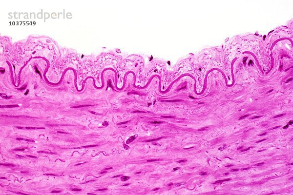 Teil der Wand einer großen menschlichen elastischen Arterie mit wellenförmiger  rosa gefärbter elastischer Membran  H&E-Färbung. LM X100