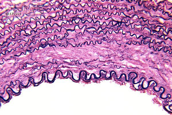 Querschnitt einer menschlichen Arterienwand  Färbung des elastischen Gewebes. LM X80