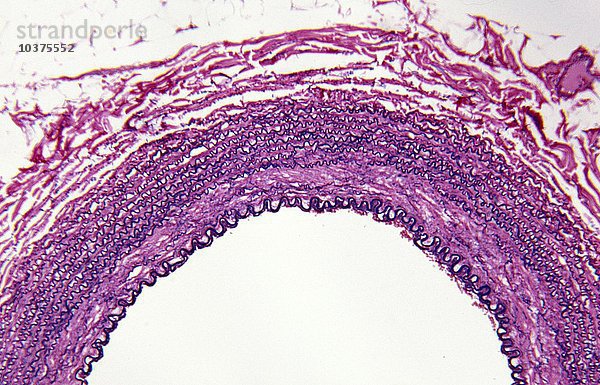 Querschnitt einer menschlichen Arterie  Färbung des elastischen Gewebes. LM X30