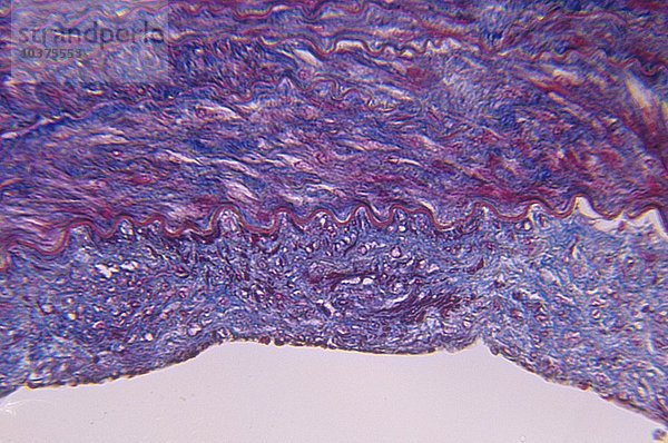 Querschnitt einer menschlichen Arterie  Färbung des elastischen Gewebes. LM X80