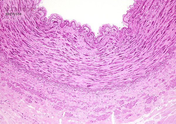 Ausschnitt aus der elastischen Wand einer menschlichen Aorta  H&E-Färbung. LM X26