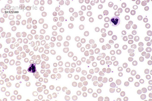 Normales menschliches peripheres Blut mit roten Blutkörperchen und einem basophilen und einem segmentierten neutrophilen Leukozyten  Wright-Färbung. LM X160.