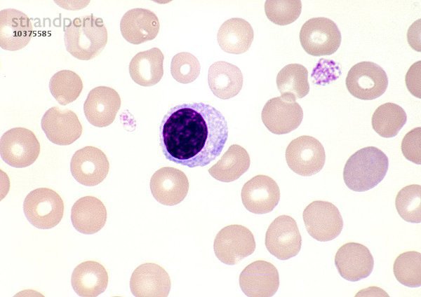 Normale menschliche Lymphozyten und rote Blutkörperchen in peripherem Blut  Wright-Färbung. LM X400.