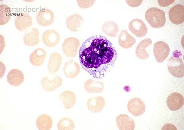Menschliche Monozyten-Leukozyten oder weiße Blutkörperchen  umgeben von roten Blutkörperchen. LM.