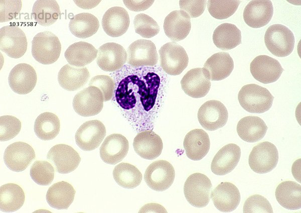 Normales menschliches Blut mit einem segmentierten polymorphkernigen Neutrophilen und roten Blutkörperchen im Hintergrund  Wright-Färbung. LM X400