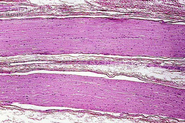 Längsschnitt eines menschlichen peripheren Nervs. LM X15.