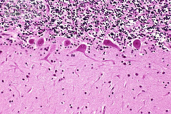 Menschliche Kleinhirn-Purkinjezellen mit sichtbaren Dendriten  die sich in die blassrosa Molekularschicht erstrecken  H&E-Färbung. LM X64