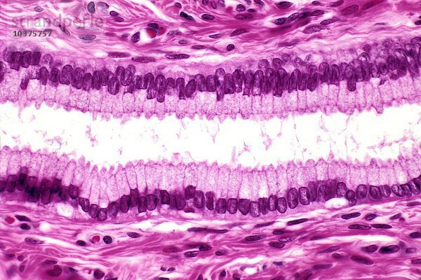 Einfaches säulenförmiges Epithel aus einer menschlichen Uterus-Endozervix  H&E-Färbung. LM X160
