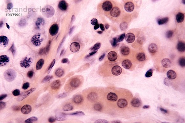 Interstitielle Zellen der Hodenkanälchen (Tubuli seminiferi). LM X240