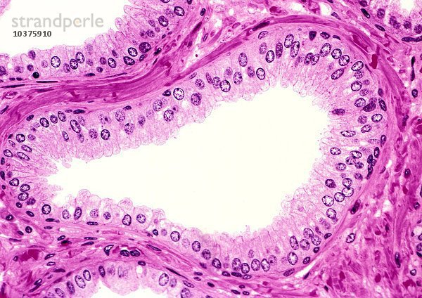 Das Prostataepithel variiert von quaderförmigen bis zu einfachen und pseudostratifizierten säulenförmigen Zellen  die die Drüsen mit dem umgebenden fibromuskulären Stroma auskleiden  H&E-Färbung. LM X100