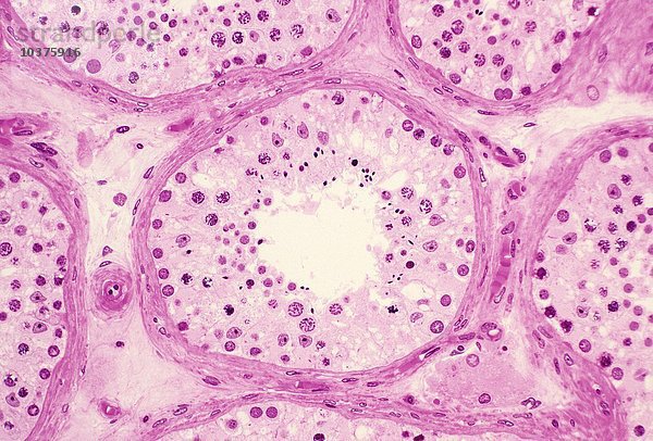 Menschliche Hodenkanälchen im erwachsenen Hoden  gefüllt mit spermatogenen Keimzellen mit laufender Spermatogenese und unterstützenden Sertoli-Zellen  H&E-Färbung. LM X64