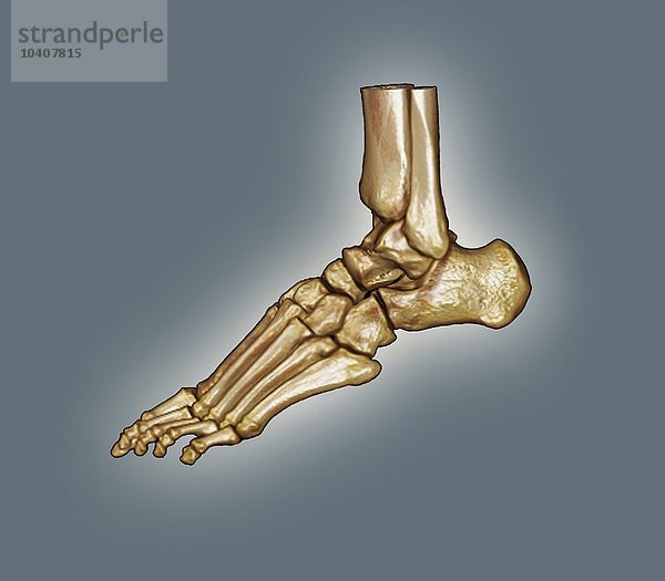 Normaler Fuß  3D-CT-Scan