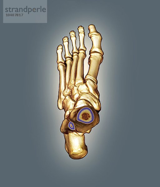Normaler Fuß  3D-CT-Scan