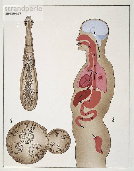 Medizin - Bandwurm (Taenia echinococcus)  Zeichnung