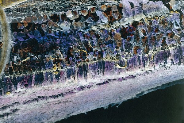 Sehsystem  Auge  Netzhaut  Sinneszellen unter dem Mikroskop
