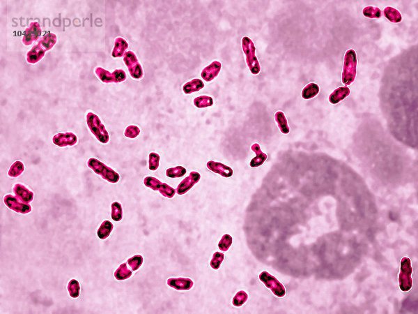 Yersinia pestis (Pasteurella pestis) ist das Bakterium  das für die Beulenpest verantwortlich ist. Optische Mikroskopie x 2000.