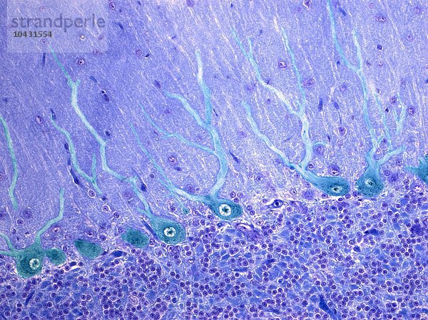 Nervenzellen. Lichtmikroskopische Aufnahme von Purkinje-Neuronen (Nervenzellen  blau) im Kleinhirn. Diese Zellen bilden die Verbindung zwischen den körnigen und molekularen Schichten der grauen Substanz des Kleinhirns. Vergrößerung: x400 bei einem Druck von 10 Zentimetern Breite.