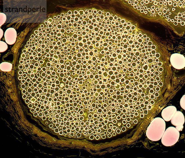 Nervenbündel. Lichtmikroskopische Aufnahme eines Schnitts durch ein Nervenbündel aus dem Ischiasnerv. Man erkennt die Myelinscheiden (helle Kreise)  die die Axone (dunkle Punkte) umgeben. Das Perineurium (Bindegewebe  braun) umgibt das Nervenbündel. Adipöse (Fett-)Zellen (rosa) umgeben das Nervenbündel. Vergrößerung: x200 bei einem Druck von 10 Zentimetern Breite.
