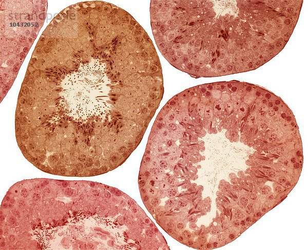 Hodenkanälchen. Farbige lichtmikroskopische Aufnahme eines Schnittes durch den Hoden  die die Hodenkanälchen (rosa) und die Leihzellen (gelb) zeigt. Dies ist der Ort der Spermienproduktion (Spermatogenese). Vergrößerung: x150 bei einer Druckbreite von 10 Zentimetern Hodenkanälchen  lichtmikroskopische Aufnahme