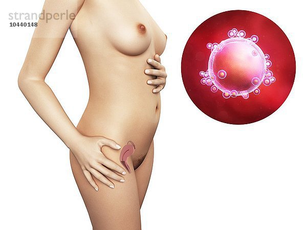 Frau und unbefruchtetes Ei. Computergrafik einer nackten Frau  die die Position des Uterus (Gebärmutter) zeigt. Rechts oben ist eine unbefruchtete Eizelle zu sehen Frau und unbefruchtete Eizelle  Kunstwerk