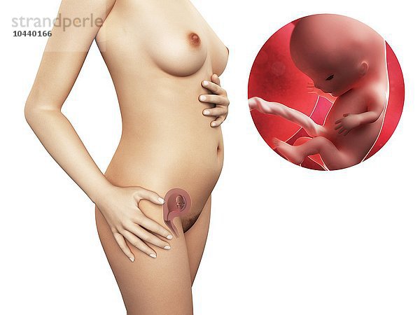 Schwangere. Computergrafik einer nackten Frau  die die Position des Uterus (Gebärmutter) zeigt. Oben rechts ist ein 11-wöchiger Fötus zu sehen. Schwangerschaft - Woche 11  Kunstwerk