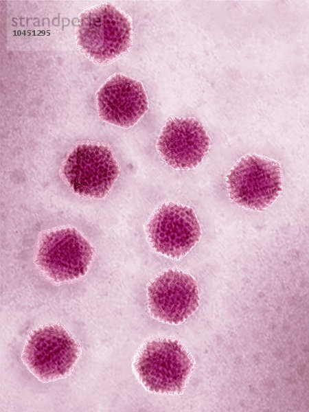 Adenovirus. Bild  das mit High Dynamic Range Imaging (HDRI) aus einem mit dem Transmissionselektronenmikroskop aufgenommenen Bild erstellt wurde. Der Virendurchmesser reicht von etwa 80 bis 110 nm.