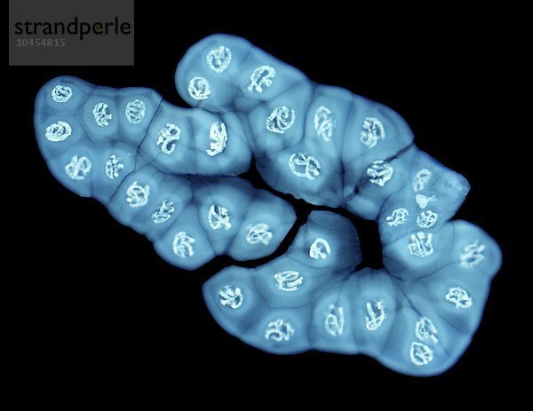 Riesenchromosomen  lichtmikroskopische Aufnahme. Polytene Chromosomen sind übergroße Chromosomen  die sich aus Standardchromosomen entwickelt haben. Man findet sie häufig im Speichel der Fruchtfliege Drosophila melanogaster. Sie entstehen durch wiederholte Sequenzen der DNA-Replikation (Desoxyribonukleinsäure) ohne Kernteilung. Dieser Vorgang ist als Endoreduplikation bekannt. Polytene Chromosomen erhöhen das Zellvolumen und die Stoffwechselrate  da mehr Gene exprimiert werden können. Vergrößerung: x20 bei einer Druckbreite von 10 Zentimetern Riesenchromosomen  lichtmikroskopische Aufnahme