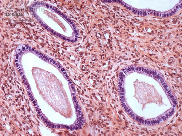 Gebärmutterhals. Lichtmikroskopische Aufnahme eines Schnitts durch die Schleimhaut des Gebärmutterhalses (Zervix). Die violett umrandeten Bereiche sind Zervixdrüsen  die Schleim produzieren (rosa im Inneren der Drüsen). Vergrößerung: x250 bei einer Druckbreite von 10 Zentimetern Gebärmutterhals  Lichtmikroskopische Aufnahme