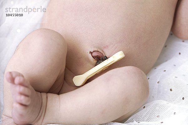 Nabelschnurclip bei einem 4 Tage alten Baby Nabelschnurclip